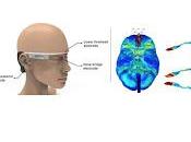 Estimulador eléctrico portátil elimina enfermedad Alzheimer