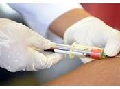 Análisis Sangre podría diagnosticar Depresión Trastorno Bipolar