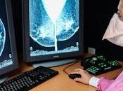 Informa salud edoméx retoman actividades unidades móviles mastografía