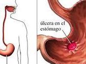 Perspectiva: aplicación plata úlceras crónicas cicatrizan