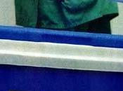 Tipos rechazo órganos factores influyen compatiblidad.