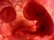 ¿Que causa Abortos Expontaneos?