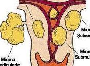 relación miomas embarazo