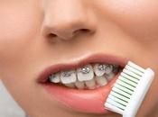 Problemas puede causar ortodoncia aplicada