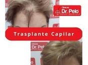 ¿Cómo frenar entradas pelo gracias Clínicas Pelo? importancia trasplante capilar cuando existe pérdida cabello