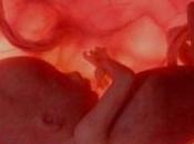 aborto diez falacias mundo conservador