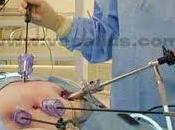 Tratamiento para recuperación cálculos colédoco durante colecistectomía laparoscópica