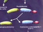Tratamiento antibiótico: algoritmos basados Procalcitonina