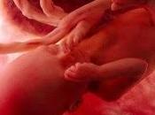 Alabama reconoce personalidad juridica niño nacido