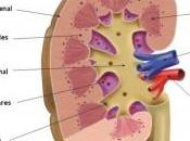 Abuso Analgésicos Aumenta Riesgo Cáncer Riñón