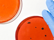 Inteligencia Artificial para combatir bacterias resistentes antibióticos