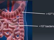 Test Colon Irritable: test disponibles para