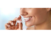 Alternativas Invisalign