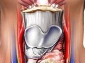 Aumento cáncer tiroides