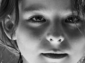 Proteína fluído ocular puede ayudar diseñar tratamiento para degeneración macular.