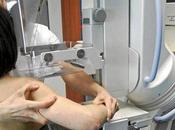 Radiación estudios mamarios