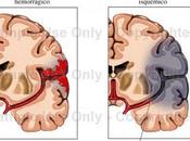 circulación colateral accidente cerebrovascular agudo