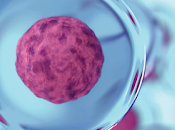 ¿Hay tratamiento seguro células madre para glaucoma 2023?