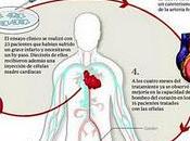 Médicos EE.UU. muestran mejoría pacientes infartados propias células