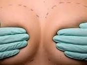 Tratamiento contra contractura capsular implantes mamarios