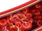 Trombosis venosa: síntomas cómo tratarla
