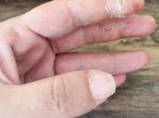esmalte semipermanente daña uñas?