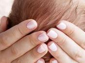 Ictericia neonato: causas síntomas tratamiento