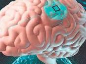 Mediante implante cerebral restablecen habla
