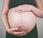 Tratamiento problemas sufrir clamidia durante embarazo