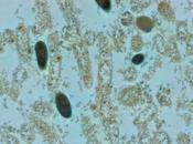 Como restaurar bacterias vaginales luego infección