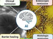 Tratamiento preciso enfermedad inflamatoria intestinal