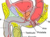 Cáncer próstata
