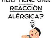 ¿Qué hacer hijo tiene reacción alérgica? primeros pasos