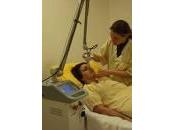 Laser Fraccionado elimina Acne