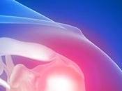 Como prevenir lesiones hombro