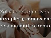 Soluciones efectivas para pies manos resequedad extrema