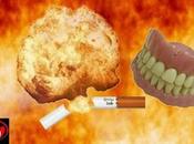 explota cigarro electrónico destrozándole varios dientes lengua