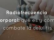 Radiofrecuencia corporal: cómo combate celulitis