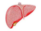 Primer fármaco revierte daño enfermedad hígado graso