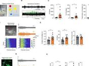 Revierten síntomas autismo fármaco experimental