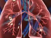 enfermedad mortal mundo vuelve estar aumento