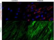 Resuelven misterio médico esta enfermedad multiorgánica
