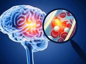 Reconocer ictus primeras fases permite reducir secuelas mejorar recuperación