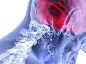 Cualquiera puede sufrir accidente cerebrovascular