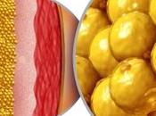 Cómo grasa visceral acelera envejecimiento corazón aunque hagas ejercicio