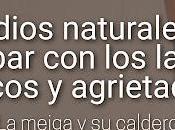 Remedios Naturales para Acabar Labios Secos Agrietados