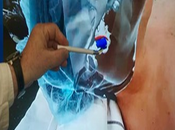 cirugía futuro hace hospital público Coghlan: como opera realidad aumentada