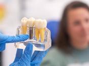 implantes dentales consolidan como opción preferida para recuperar dientes perdidos